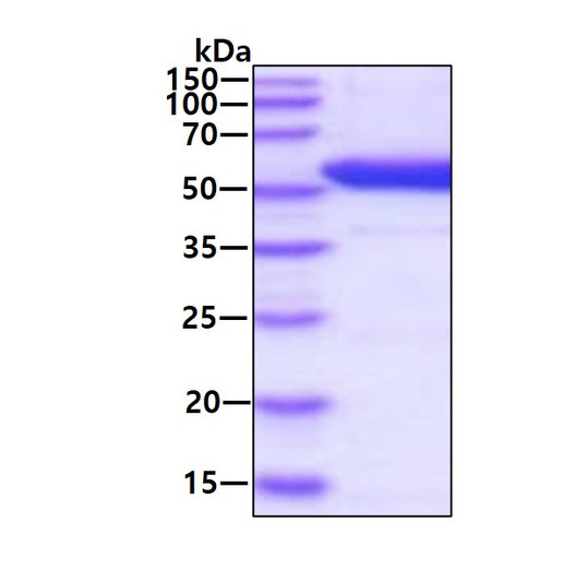 SDS-PAGE gel of recombinant human Dopa Decarboxylase DDC protein under reducing conditions