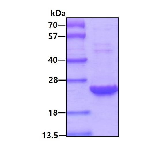 SDS-PAGE gel showing recombinant human Peroxiredoxin 2 PRDX2 protein 3µg under reducing conditions