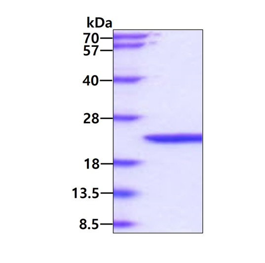 SDS-PAGE gel of recombinant mouse IFN-beta 1 IFNB1 protein under reducing conditions stained with Coomassie blue
