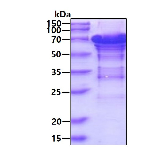 SDS-PAGE gel of recombinant human Chromogranin A CHGA protein under reducing conditions
