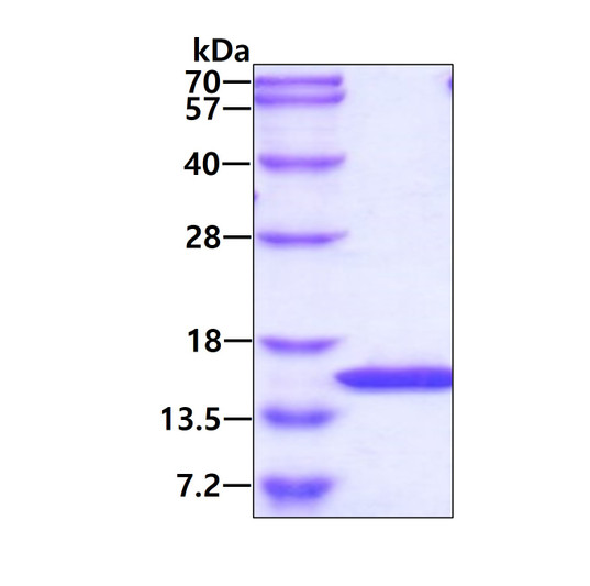 SDS-PAGE gel of recombinant human TBCA protein 3 μg under reducing conditions with Coomassie blue stain