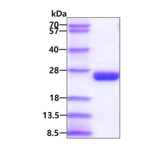 SDS-PAGE gel of recombinant human IL-6 protein 3 µg under reducing conditions stained with Coomassie blue