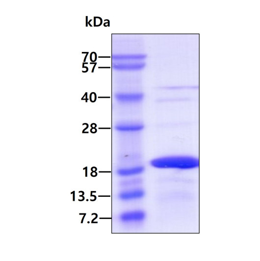 SDS-PAGE gel of recombinant human Midkine protein STJP016496 under reducing conditions with Coomassie staining