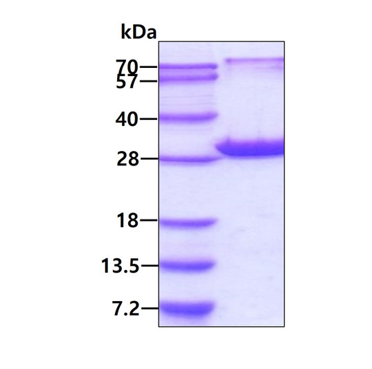 SDS-PAGE gel of recombinant human Peroxiredoxin 6 PRDX6 protein under reducing conditions