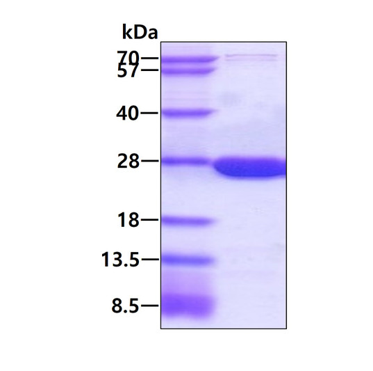 SDS-PAGE gel of recombinant human DHFR protein 3µg under reducing conditions Coomassie blue stain