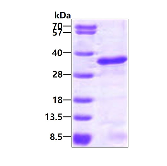 SDS-PAGE gel showing recombinant human E2-EPF UBE2S protein 3 μg under reducing conditions with Coomassie blue staining