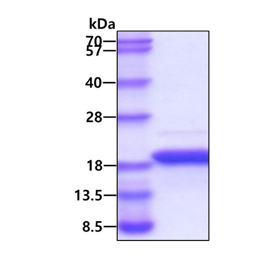 SDS-PAGE gel of recombinant human 4E-BP1 EIF4EBP1 protein under reducing conditions stained with Coomassie blue