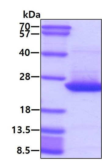 SDS-PAGE gel of recombinant human CDC42 protein under reducing conditions stained with Coomassie blue