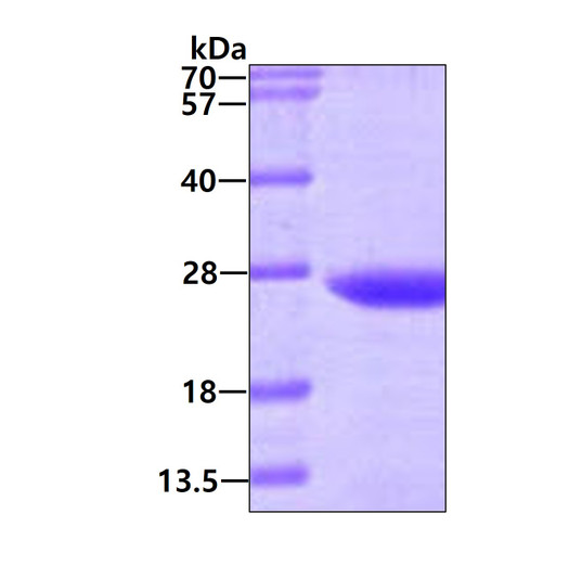 SDS-PAGE gel of recombinant human VPS28 protein 3µg under reducing conditions Coomassie blue stain