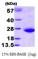 SDS-PAGE of recombinant human RAC1 protein under reducing conditions with Coomassie blue stain