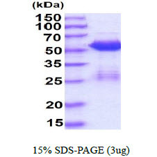 SDS-PAGE gel of recombinant human Smad3 protein under reducing conditions Coomassie blue stain