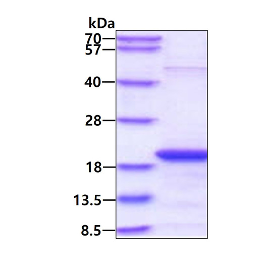 SDS-PAGE gel of recombinant human SKP1 protein 3µg under reducing conditions with Coomassie blue stain