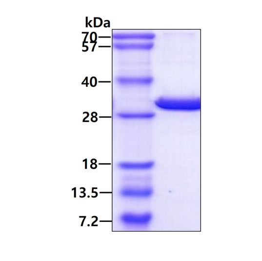 SDS-PAGE of recombinant human 14-3-3 sigma protein under reducing conditions