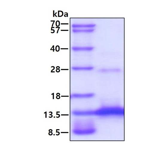 SDS-PAGE of recombinant human CCL11 Eotaxin-1 protein under reducing conditions with Coomassie blue stain