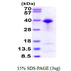 SDS-PAGE gel of recombinant human GTF2B protein under reducing conditions