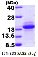 SDS-PAGE gel of recombinant human SDNSF MCFD2 protein under reducing conditions