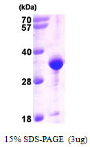 SDS-PAGE of recombinant human VAP-A protein under reducing conditions stained with Coomassie blue