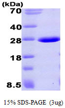 SDS-PAGE gel of recombinant human Aprataxin APTX protein 3µg under reducing conditions Coomassie blue stain