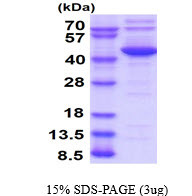 SDS-PAGE of recombinant human GOPC protein under reducing conditions with Coomassie blue stain