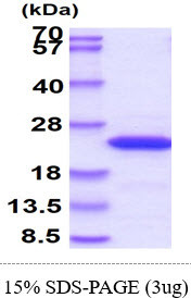 SDS-PAGE gel of recombinant human N-RAS protein 3µg under reducing conditions Coomassie blue stain