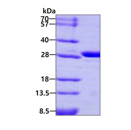 SDS-PAGE of recombinant human CA3 protein 3µg under reducing conditions stained with Coomassie blue