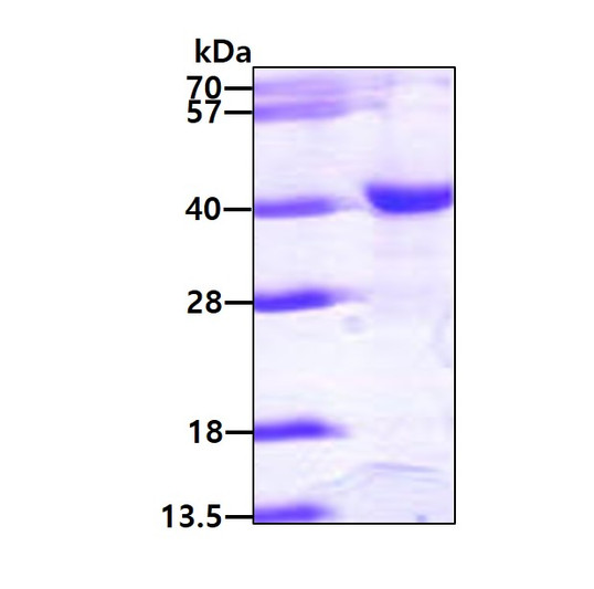 SDS-PAGE gel of recombinant human HAT1 protein 3 µg under reducing conditions Coomassie blue stain