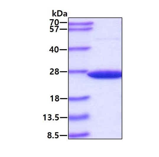 SDS-PAGE gel of recombinant human SOD2 Mn-SOD protein 3 µg under reducing conditions stained with Coomassie blue