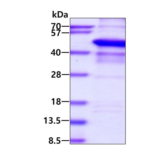 SDS-PAGE gel of recombinant human p62 SQSTM1 protein under reducing conditions stained with Coomassie blue