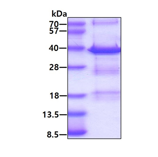 SDS-PAGE gel of recombinant human MED4 protein 3µg under reducing conditions Coomassie blue stain