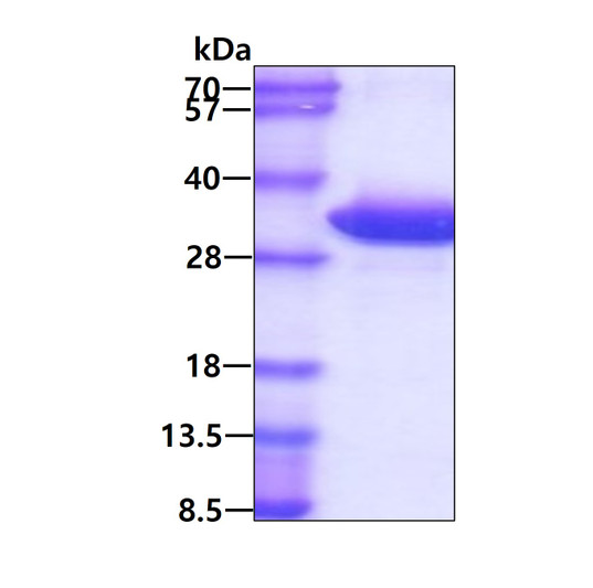 SDS-PAGE gel showing 3µg recombinant human CLIC1 protein under reducing conditions with Coomassie blue stain