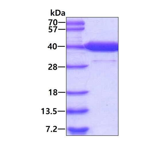 SDS-PAGE of recombinant human PIG3 TP53I3 protein under reducing conditions