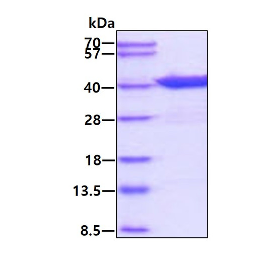 SDS-PAGE gel of recombinant human eIF-2 alpha EIF2S1 protein under reducing conditions