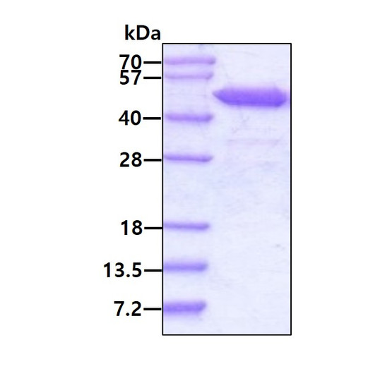 SDS-PAGE gel of recombinant human RRM2 protein 3µg under reducing conditions stained with Coomassie blue