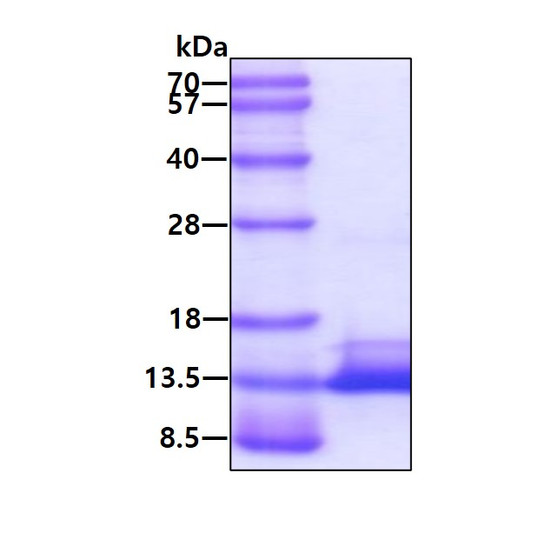 SDS-PAGE gel showing recombinant human ICAT CTNNBIP1 protein 3µg under reducing conditions with Coomassie blue stain