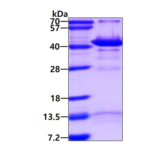 SDS-PAGE gel of recombinant human GIPC1 protein stained with Coomassie blue