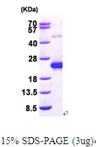 SDS-PAGE gel of recombinant human DCTD protein under reducing conditions Coomassie blue stain