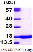 SDS-PAGE gel of recombinant mouse alpha-Synuclein protein under reducing conditions