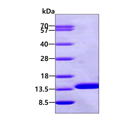 SDS-PAGE gel of recombinant human beta 2-Microglobulin protein under reducing conditions stained with Coomassie blue