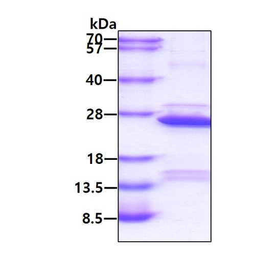 SDS-PAGE gel of recombinant human COMMD1 protein under reducing conditions Coomassie blue stain