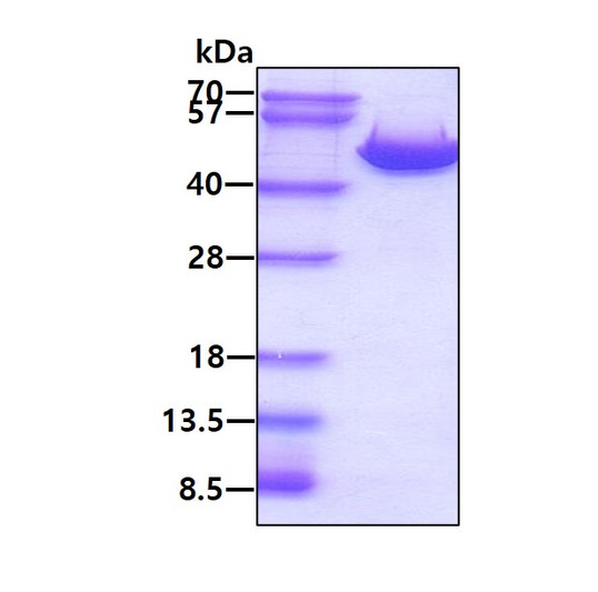 SDS-PAGE of recombinant human ASS1 protein under reducing conditions with Coomassie blue stain