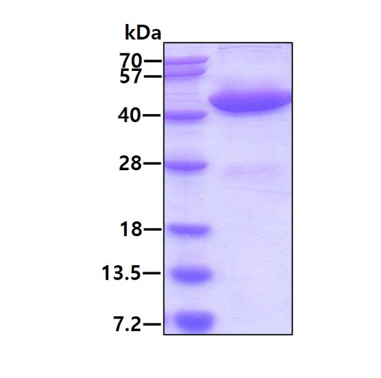 SDS-PAGE of recombinant human GALK1 protein under reducing conditions Coomassie blue stain