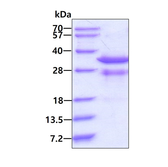 SDS-PAGE gel of recombinant human RAD1 protein 3µg reducing conditions Coomassie stain