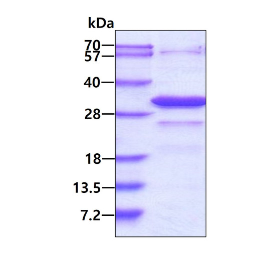 SDS-PAGE gel of recombinant human HIF-1 alpha protein under reducing conditions stained with Coomassie blue