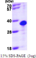 SDS-PAGE gel of recombinant human THTPA protein 3µg under reducing conditions Coomassie blue stain