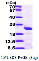 SDS-PAGE gel showing recombinant human CETN3 protein 3µg under reducing conditions with Coomassie blue staining