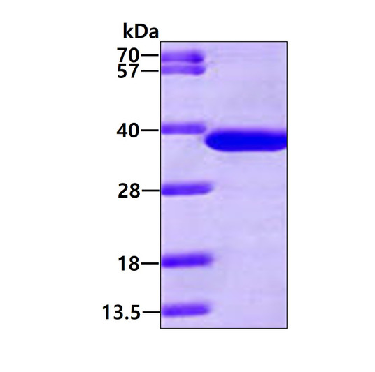 SDS-PAGE gel of recombinant human NAPA protein 3µg under reducing conditions stained with Coomassie blue