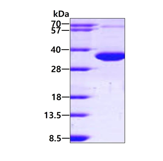 Recombinant human CCS protein SDS-PAGE under reducing conditions visualized by Coomassie blue stain
