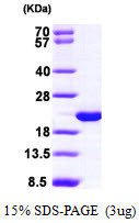 SDS-PAGE gel showing recombinant human HPCAL1 protein 3µg under reducing conditions stained with Coomassie blue