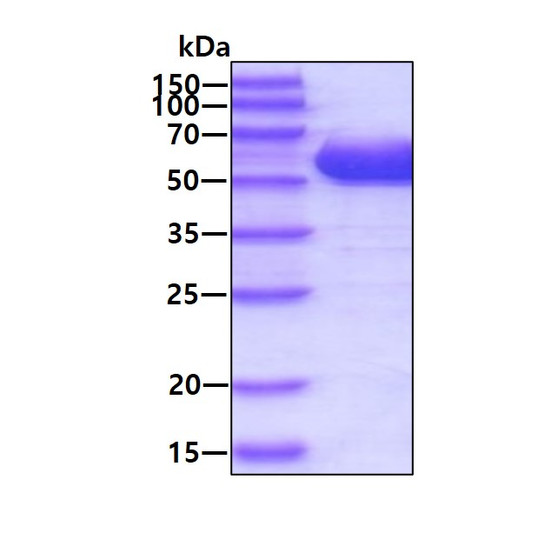 SDS-PAGE gel of recombinant human ALDH5A1 protein under reducing conditions Coomassie blue stain