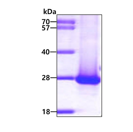 SDS-PAGE gel showing recombinant human DIRAS1 protein 3µg under reducing conditions Coomassie stain